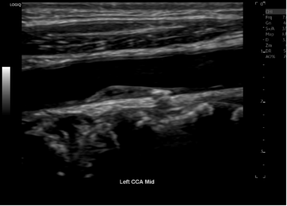Picture of Vascular Ultrasound Tuition 